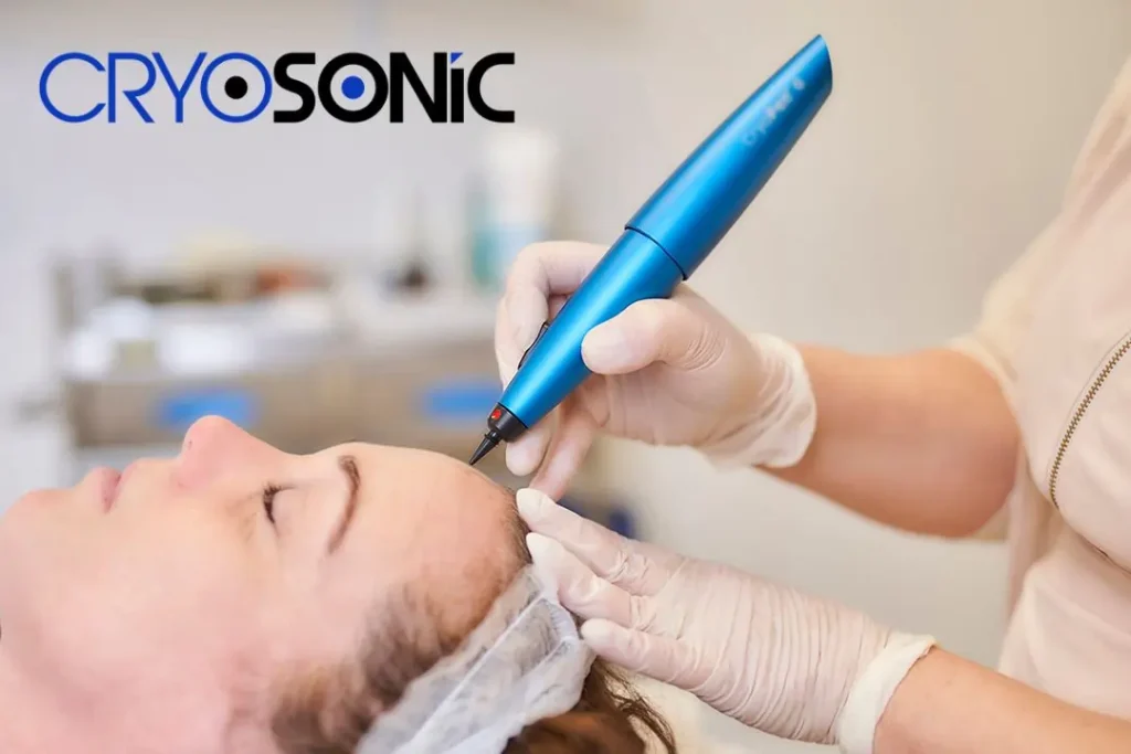Cryopen Aftercare Tips for Optimal Healing Leicester